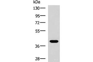 Western blot analysis of HepG2 cell lysate using PLPPR5 Polyclonal Antibody at dilution of 1:1500 (LPPR5 抗体)