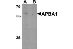 Western blot analysis of APBA1 in rat brain tissue lysate with APBA1 Antibody  at 0.