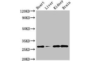 Western Blot Positive WB detected in: Mouse heart tissue, Mouse liver tissue, Mouse kidney tissue, Mouse brain tissue All lanes: GUCD1 antibody at 4 μg/mL Secondary Goat polyclonal to rabbit IgG at 1/50000 dilution Predicted band size: 28, 34 kDa Observed band size: 28 kDa (C22orf13 抗体  (AA 1-136))