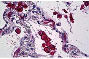 Human Lung, Macrophages: Formalin-Fixed, Paraffin-Embedded (FFPE) (Mannose Receptor 抗体  (AA 22-131))