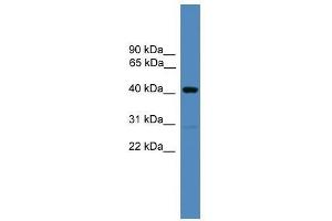 ADRM1 antibody used at 0. (ADRM1 抗体  (C-Term))