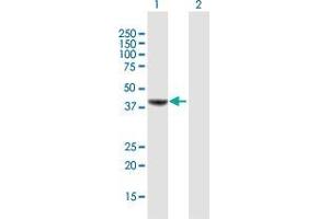 Western Blot analysis of MVD expression in transfected 293T cell line by MVD MaxPab polyclonal antibody. (MVD 抗体  (AA 1-400))