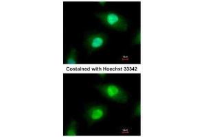 ICC/IF Image Immunofluorescence analysis of paraformaldehyde-fixed HeLa, using Casein Kinase 2 beta, antibody at 1:500 dilution.