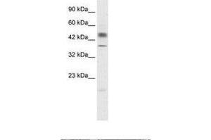 Image no. 2 for anti-POU Class 3 Homeobox 1 (POU3F1) (N-Term) antibody (ABIN202549)