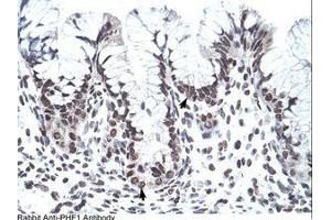 Image no. 1 for anti-PHD Finger Protein 1 (PHF1) (AA 421-470) antibody (ABIN202770) (PHF1 抗体  (AA 421-470))