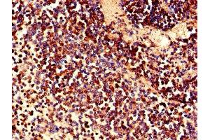 Immunohistochemistry of paraffin-embedded human spleen tissue using ABIN7158066 at dilution of 1:100 (LRRFIP1 抗体  (AA 1-315))