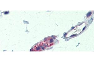 Immunohistochemistry (IHC) image for anti-Tankyrase, TRF1-Interacting Ankyrin-Related ADP-Ribose Polymerase (TNKS) (Middle Region) antibody (ABIN2778109)
