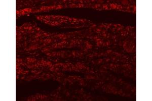 IF analysis of SF3A1 using anti-SF3A1 antibody (ABIN7600556). (SF3A1 抗体  (AA 20-556))