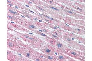 Anti-PLA2G5 antibody IHC of human heart. (PLA2G5 抗体)