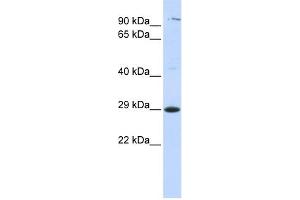 WB Suggested Anti-TSPAN2 Antibody Titration:  0. (Tetraspanin 2 抗体  (Middle Region))