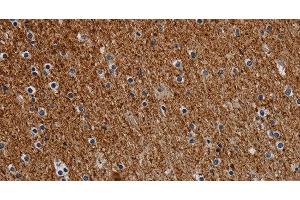 Immunohistochemistry of paraffin-embedded Human brain tissue using DCAF6 Polyclonal Antibody at dilution 1:30 (DCAF6 抗体)