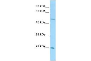 Host:  Rabbit  Target Name:  Ube2h  Sample Type:  Mouse Testis lysates  Antibody Dilution:  1.