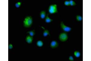Immunofluorescence staining of MCF-7 cells with ABIN7164840 at 1:166, counter-stained with DAPI. (Prosaposin 抗体  (AA 311-391))