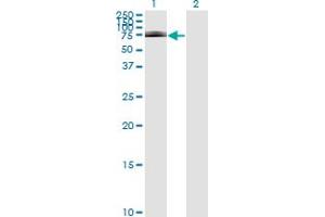 Western Blot analysis of IRAK1 expression in transfected 293T cell line by IRAK1 monoclonal antibody (M01), clone 3F7. (IRAK1 抗体  (AA 530-693))