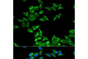 Immunofluorescence analysis of MCF-7 cells using CHMP2B Polyclonal Antibody (CHMP2B 抗体)