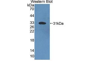 Western blot analysis of the recombinant protein. (Complement C4 抗体  (AA 126-366))