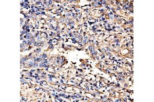 IHC analysis of HECTD1 using anti-HECTD1 antibody (ABIN7601584).