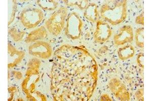 Immunohistochemistry of paraffin-embedded human kidney tissue using ABIN7143947 at dilution of 1:100 (SNCA 抗体  (AA 61-140))