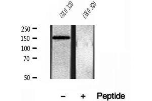 Western blot analysis of extracts of COLO 320 cells, using KIAA1199 antibody. (CEMIP 抗体  (C-Term))