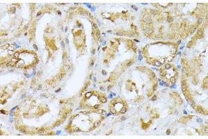 Immunohistochemistry of paraffin-embedded Rat kidney using RPS27A Polyclonal Antibody at dilution of 1:100 (40x lens). (RPS27A 抗体)