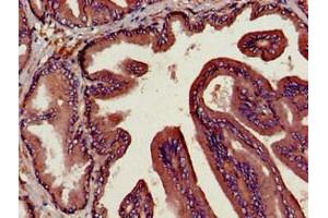 Immunohistochemistry of paraffin-embedded human prostate tissue using ABIN6953148 at dilution of 1:100