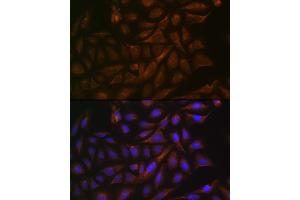 Immunofluorescence analysis of U-2 OS cells using V/V/Cellubrevin Rabbit mAb (ABIN7271314) at dilution of 1:100 (40x lens). (VAMP3 抗体)