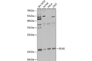 Western blot analysis of extracts of various cell lines, using DLX6 Antibody (ABIN6131792, ABIN6139675, ABIN6139676 and ABIN6223589) at 1:1000 dilution. (DLX6 抗体  (AA 119-293))