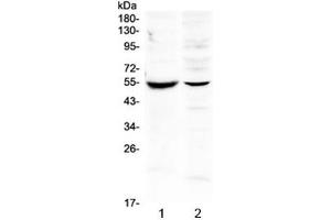 Western blot testing of 1) mouse intestine and 2) human SMMC-7721 lysate with MMP16 antibody at 0. (MMP16 抗体)