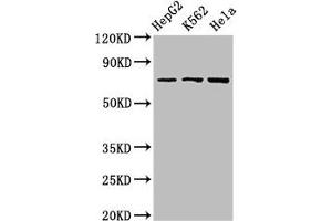 Western Blot Positive WB detected in: HepG2 whole cell lysate, K562 whole cell lysate, Hela whole cell lysate All lanes: DBF4 antibody at 2. (DBF4 抗体  (AA 101-281))