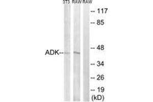 Western blot analysis of extracts from RAW264. (ADK 抗体  (AA 1-50))