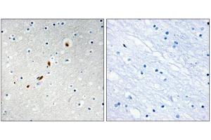 Immunohistochemistry analysis of paraffin-embedded human brain tissue using ZNF596 antibody. (ZNF596 抗体  (Internal Region))