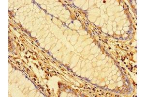 Immunohistochemistry (IHC) image for anti-Karyopherin alpha 2 (RAG Cohort 1, Importin alpha 1) (KPNA2) (AA 2-285) antibody (ABIN7156118)
