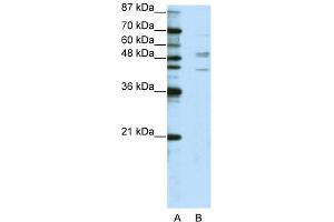 WB Suggested Anti-SMAD2 Antibody Titration:  2. (SMAD2 抗体  (N-Term))