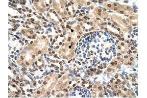 IFIT3 antibody was used for immunohistochemistry at a concentration of 4-8 ug/ml to stain EpitheliaI cells of renal tubule (arrows) in Human Kidney. (IFIT3 抗体  (N-Term))