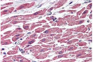 Human Heart (formalin-fixed, paraffin-embedded) stained with TSC1 antibody ABIN214539 at 2. (TSC1 抗体)