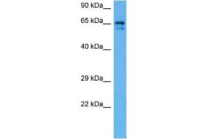 Host:  Rabbit  Target Name:  SLC6A2  Sample Tissue:  Rat Brain  Antibody Dilution:  1ug/ml (SLC6A2 抗体  (Middle Region))