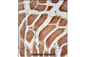 SIKE Antibody (C-term) (ABIN651568 and ABIN2840305) immunohistochemistry analysis in formalin fixed and paraffin embedded human skeletal muscle followed by peroxidase conjugation of the secondary antibody and DAB staining. (SIKE1 抗体  (C-Term))