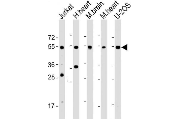 IRX4 Antikörper  (AA 107-141)
