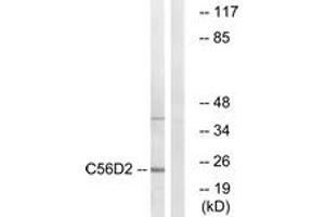 Western blot analysis of extracts from Jurkat cells, using C56D2 Antibody. (CYB561D2 抗体  (AA 55-104))