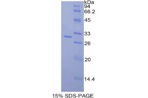 SDS-PAGE analysis of Mouse MAdCAM1 Protein. (MADCAM1 蛋白)