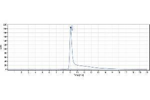 anti-SLITRK6 (Sirtratumab Biosimilar) antibody