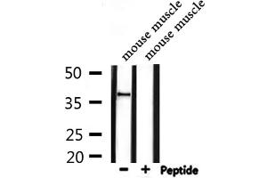 Western blot analysis of extracts from mouse muscle, using DOK4 Antibody. (DOK4 抗体  (N-Term))