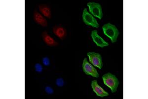 ABIN6262216 and ABIN6269364 staining Hela cells by IF/ICC. (ERBB4 抗体  (C-Term))