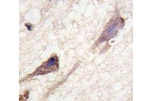IHC analysis of FFPE human brain tissue stained with BRAF antibody