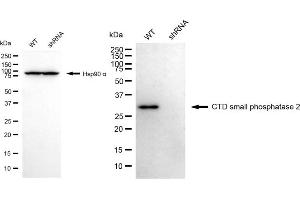 Western blotting analysis using CTD small phosphatase 2 antibody (ABIN7798173).