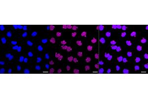 Immunocytochemical staining of Hela cells with GATAD2A antibody (ABIN7798698), 1:1,000). (Recombinant GATAD2A 抗体)