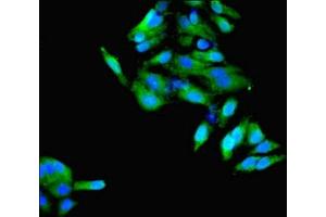 Immunofluorescent analysis of Hela cells using ABIN7148610 at dilution of 1:100 and Alexa Fluor 488-congugated AffiniPure Goat Anti-Rabbit IgG(H+L) (HSD11B1 抗体  (AA 25-292))