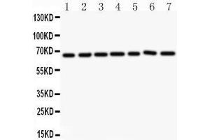 Western Blotting (WB) image for anti-Angiopoietin 1 (ANGPT1) (AA 16-350) antibody (ABIN3043724) (Angiopoietin 1 抗体  (AA 16-350))