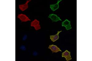 ABIN6257035 and ABIN6275629 staining Hela cells by IF/ICC. (Thrombomodulin 抗体  (C-Term))