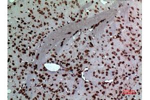 Immunohistochemistry (IHC) analysis of paraffin-embedded Rat Brain, antibody was diluted at 1:100. (Midkine 抗体  (Internal Region))